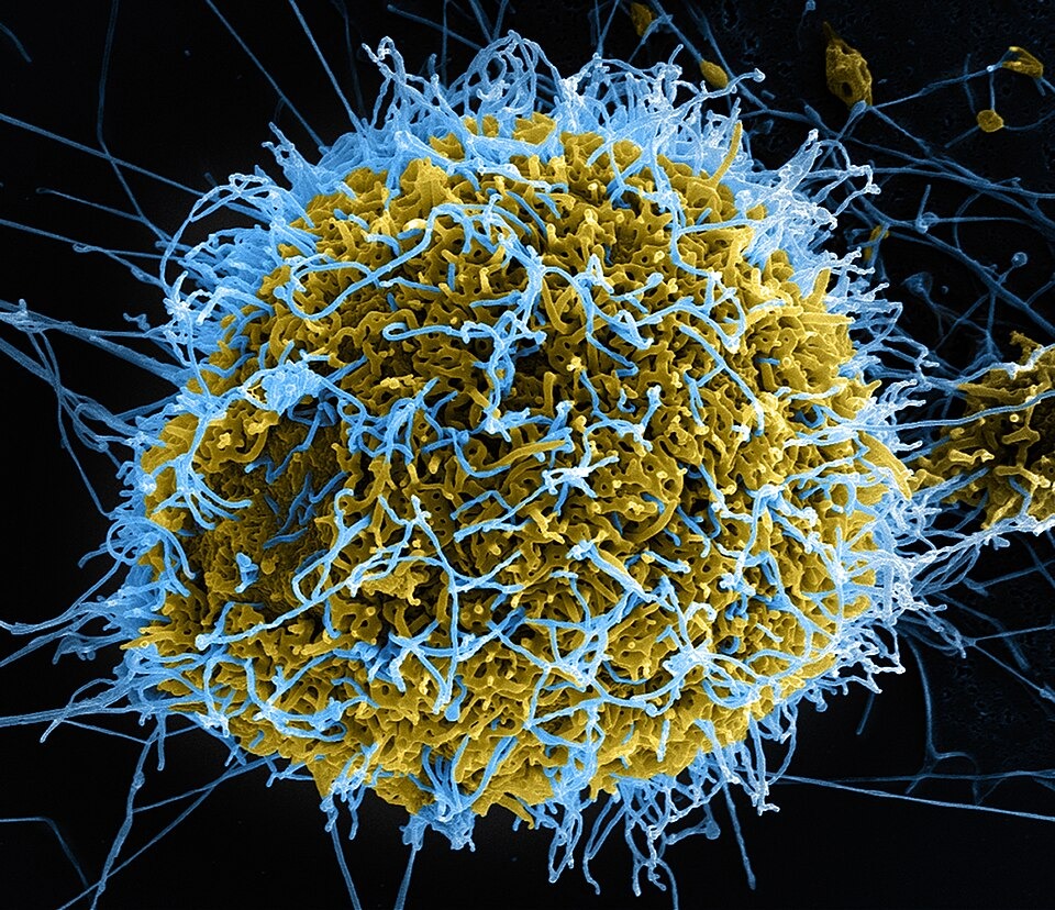 Over 200 Reported Dead as Health Systems Struggle to Contain Ebola Surge