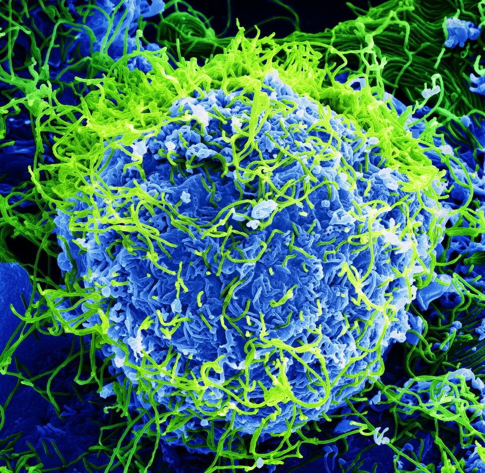 Ebola Outbreak Spreads Across Borders in DRC, Raising Global Alarm