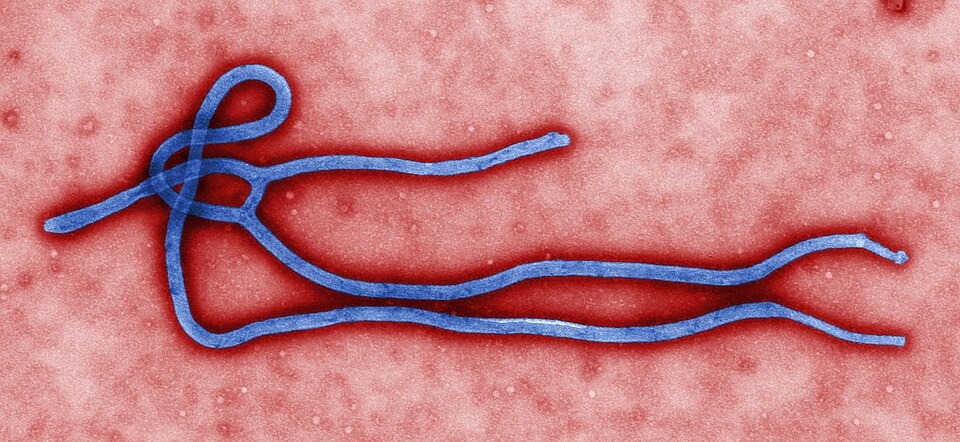 Ebola Outbreak in DR Congo Claims 828 Lives as Cases Surpass 2,100