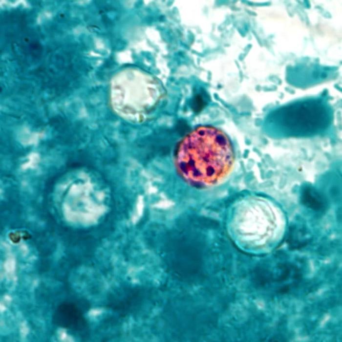 Michigan Reports First Two U.S. Deaths Linked to Major Cyclospora Outbreak